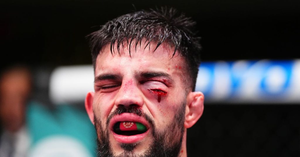 Nasrat Haqparast suffered gruesome cut during UFC Vegas 103 win, doctor share before and after photos