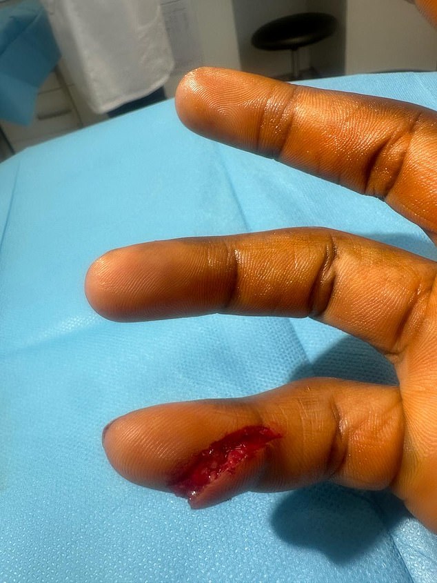 Joe Joyce ‘to fight fellow Olympic medallist’ after Dillian Whyte pulled out of their all-British clash with a gruesome finger injury